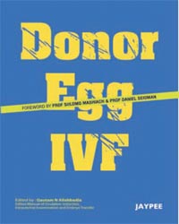 Donor Egg IVF|1/e