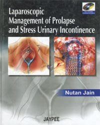 Laparoscopic Management of Prolapse and Stress Urinary Incontinence (with 2 DVD-ROMs)|1/e