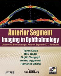 Anterior Segment Imaging in Ophthalmology (with DVD-ROM)|1/e