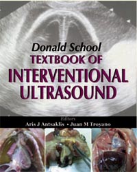 Donald School Textbook of Interventional Ultrasound|1/e