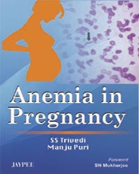 Anemia in Pregnancy|1/e