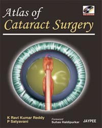 Atlas of Cataract Surgery (with DVD-ROM)|1/e