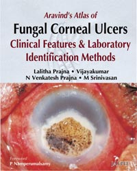 Aravind's Atlas of Fungal Corneal Ulcers: Clinical Features & Laboratory Identification Methods|1/e