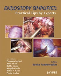 Endoscopy Simplified|1/e