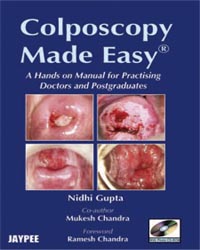 Colposcopy Made Easy with Photo CD-ROM|1/e