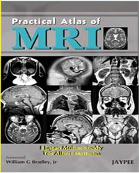 Practical Atlas of MRI|1/e
