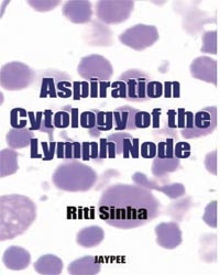 Aspiration Cytology of the Lymph Node|1/e