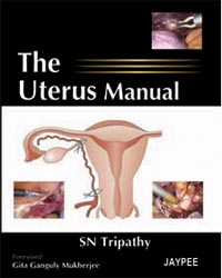 The Uterus Manual|1/e