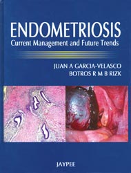 Endometriosis|1/e