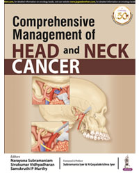 Comprehensive Management of Head and Neck Cancer|1/e