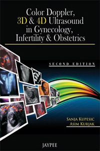 Color Doppler 3D & 4D Ultrasounds in Gynecology Infertility and Obstetrics  2/ed |2/e