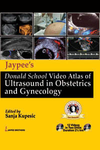 Jaypeeâ€™s Donald School Video Atlas Of Ultrasound in Obstetrics and Gynecology|1/e