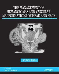 The Management of Hemangiomas and Vascular Malformations of Head and Neck|1/e