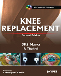 Knee Replacement  (With Interactive DVD-Rom)|1/e