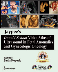 Jaypeeâ€™s Donald School Video Atlas of Ultrasound in Fetal Anomalies and Gynecologic Oncology|1/e