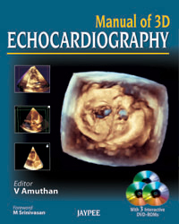 Manual of 3D Echocardiography|1/e