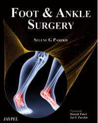 Foot and Ankle Surgery|1/e