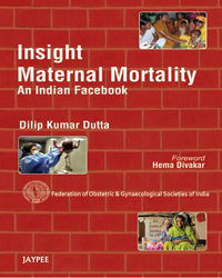Insight Maternal Mortality â€“ An Indian Facebook|1/e