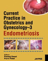Current Practice in Obstetrics and Gynecology-3: Endometriosis|1/e