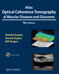 Atlas Optical Coherence Tomography of Macular Diseases and Glaucoma|4/e