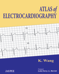 Atlas of Electrocardiography|1/e