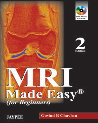 MRI Made Easy (for Beginners)|2/e