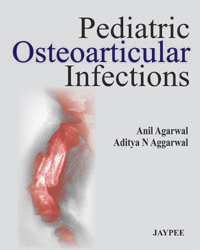 Pediatric Osteoarticular Infections|1/e