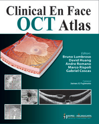 Clinical En Face OCT Atlas|1/e
