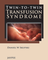 Twin-to-Twin Transfusion Syndrome|1/e