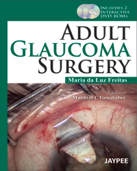 Adult Glaucoma Surgery|1/e