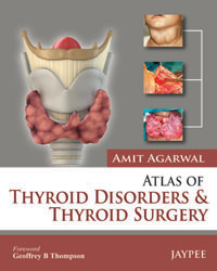 Atlas of Thyroid Disorders and Thyroid Surgery|1/e
