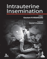 Intrauterine Insemination|3/e