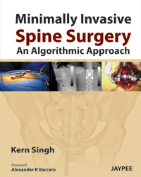 Minimally Invasive Spine Surgery: An Algorithmic Approach|1/e