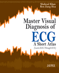 Master Visual Diagnosis of ECG: A Short Atlas (Learn ECG Through ECG)|1/e