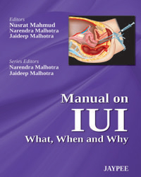 Manual on IUI: What  When and Why|1/e