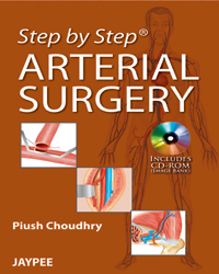 Step by Step Arterial Surgery|1/e