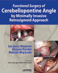 Functional Surgery of Cerebellopontine Angle by Minimally Invasive Retrosigmoid Approach|1/e