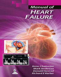 Manual of Heart Failure|1/e