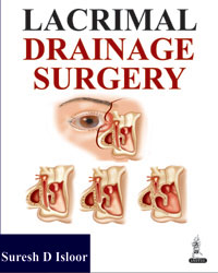 Lacrimal Drainage Surgery|1/e