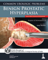 Common Urologic Problems Benign Prostatic Hyperplasia (Issues in BPH: Consensus and Controversies)|1/e