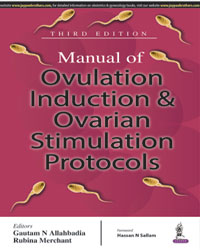 Manual of Ovulation Induction and Ovarian Stimulation Protocols|3/e