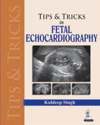 Tips and Tricks in Fetal Echocardiography|1/e