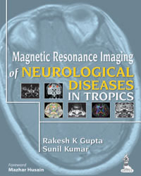 Magnetic Resonance Imaging of Neurological Diseases in Tropics|1/e