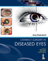 Cataract Surgery in Diseased Eyes|1/e