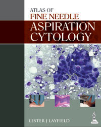 Atlas of Fine Needle Aspiration Cytology|1/e
