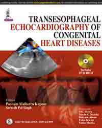 Transesophageal Echocardiography of Congenital Heart Diseases|1/e