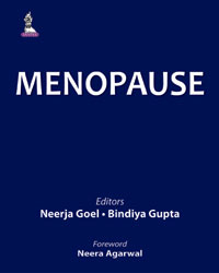 Menopause|1/e