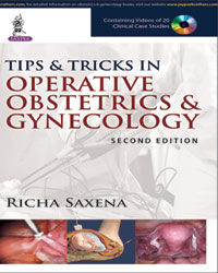 Tips & Tricks in Operative Obstetrics & Gynecology|2/e