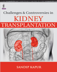 Challenges and Controversies in Kidney Transplantation|1/e