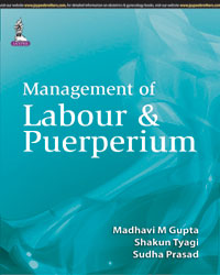 Management of Labour and Puerperium|1/e